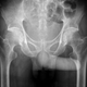 Illustration for article titled Throckmorton Sign Is A Rather Naughty Medical Condition